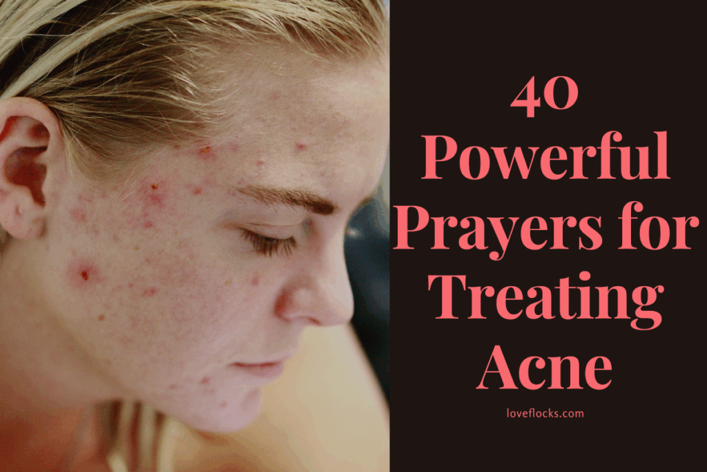 40 Powerful Prayers for Treating Acne