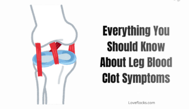 Everything You Should Know About Leg Blood Clot Symptoms